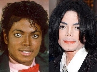 A picture of Michael Jackson before (left) and after (right).